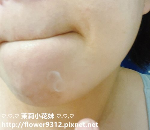 AIVÍA艾微漾 6日破黑煥白淨化組 6天美白有感 台大皮膚科權威醫師共同研發 (11).jpg
