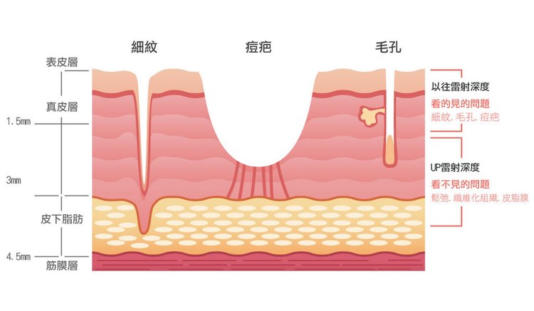 細紋、痘疤、毛孔-改.jpg