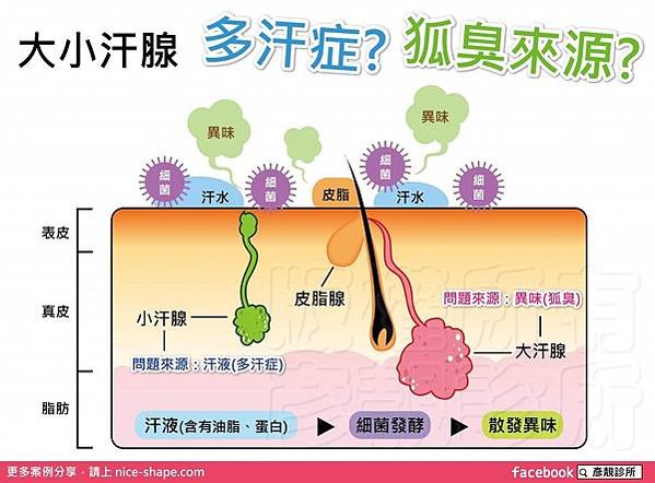 桃園-台北-桃園-腋下出汗-腋下多汗症-腋下止汗-手汗-爽身-狐臭-異味-推薦-新竹-高雄00003-1024x755.jpg