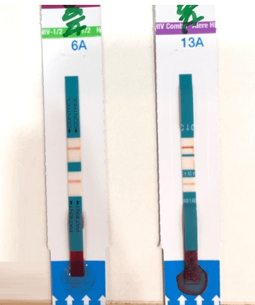 愛滋檢測hiv多久驗的出來dcard網友的困惑