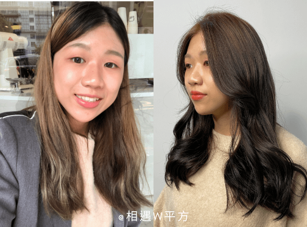 玻尿酸下巴 (3)