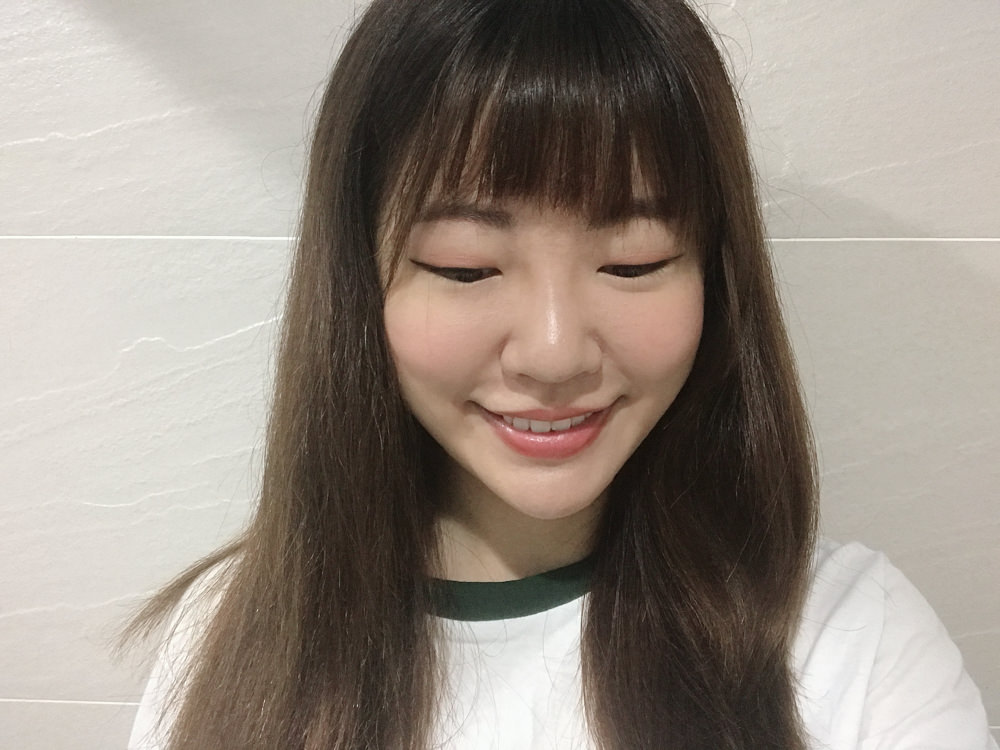 玻尿酸鼻子變寬