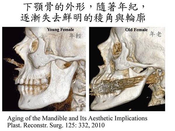 FacialBoneAging3