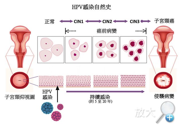 細胞變異.jpg