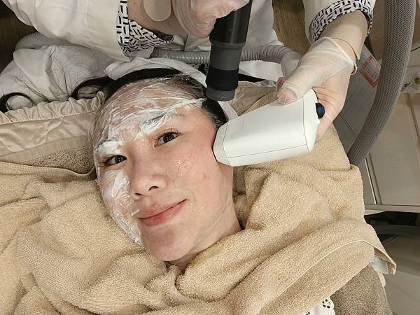 醫美推薦｜索夫波痛嗎？有用嗎？40歲三寶媽打索夫波超詳細全紀
