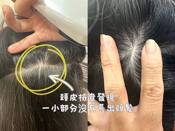 三重Ti Mei Hair Salon頭皮養護+深層護髮sp