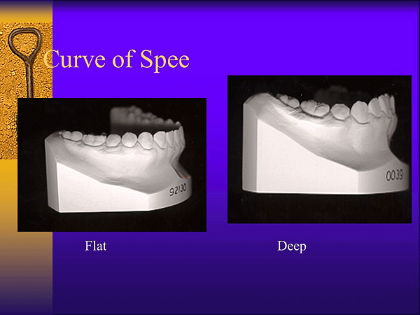 @齒顎矯正每日一說~~0154 curve of Spee(