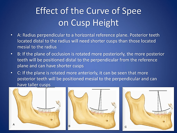 @齒顎矯正每日一說~~0154 curve of Spee(