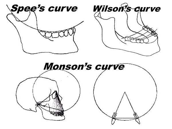 @齒顎矯正每日一說~~0154 curve of Spee(