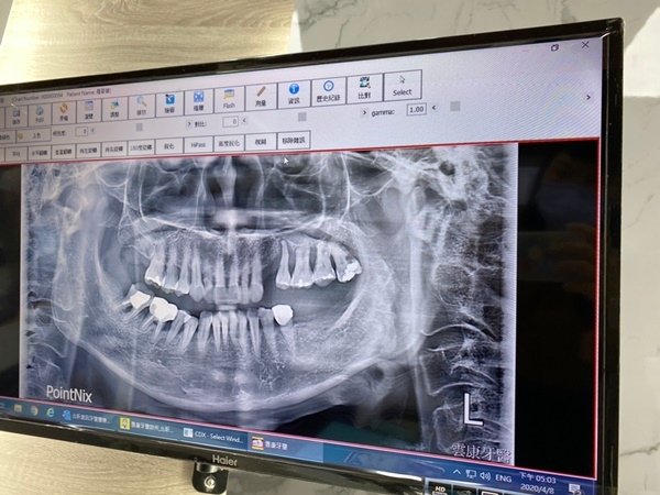 雲康牙醫_200409_0051