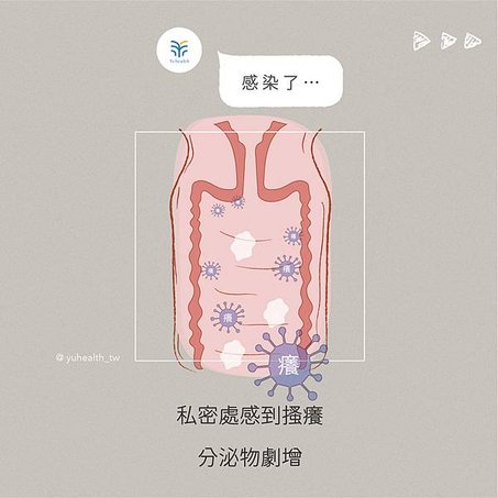 私密處感染 分泌物 蔓調私理 女性健康 生理期 排卵期  營養師Ann羽康生醫 6.jpg