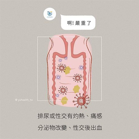 私密處感染 分泌物 蔓調私理 女性健康 生理期 排卵期  營養師Ann羽康生醫 7.jpg