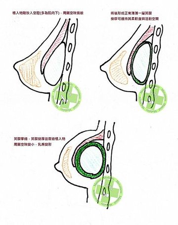 夾饃長出來3.jpg