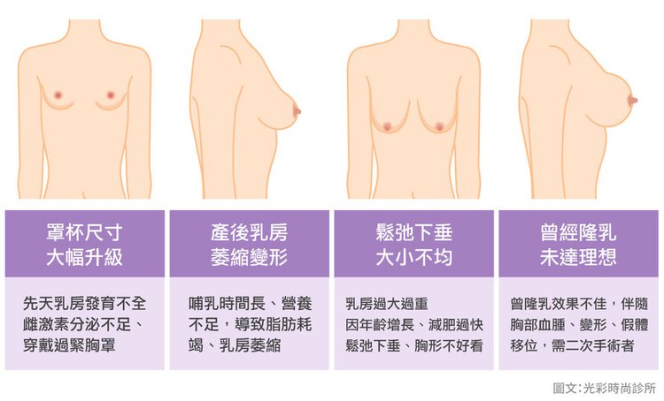 隆乳適應對象2019性感胸型乳溝內視鏡隆乳光彩時尚診所台北醫美推薦費用評價ptt術後修復期水滴隆乳果凍矽膠手術風險.jpg