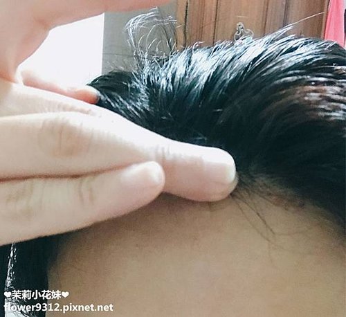 Scalp X頭皮科研養髮三部曲 (15).JPG