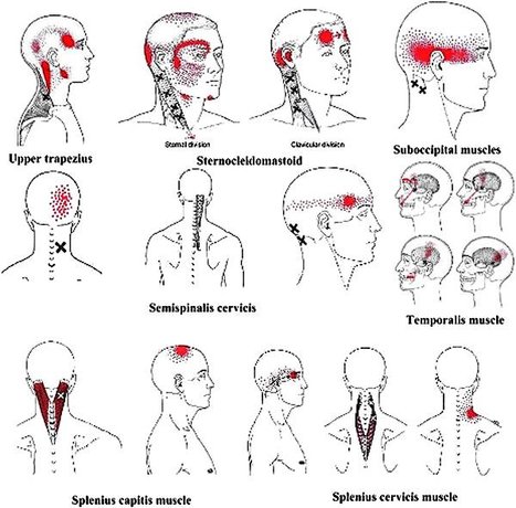 httpswww.bodyworkmovementtherapies.comarticleS1360-8592(09)00083-7fulltext.jpg