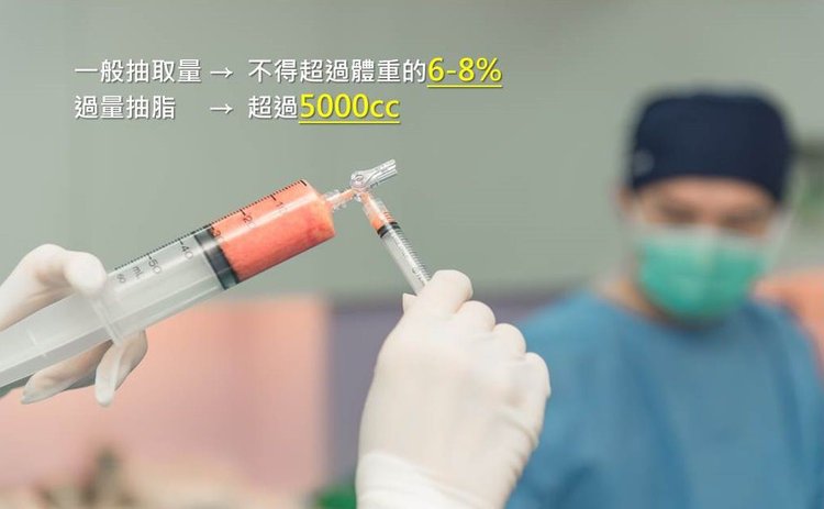台北抽脂推薦醫師 傳統抽脂 水刀抽脂 雷射溶脂 抽脂比較 抽脂手術 抽脂手術後遺症 抽脂恢復期 小腿抽脂 東區醫美 光彩時尚診所 抽脂推薦 抽脂費用 抽脂過程 郭弘義醫師2.jpg