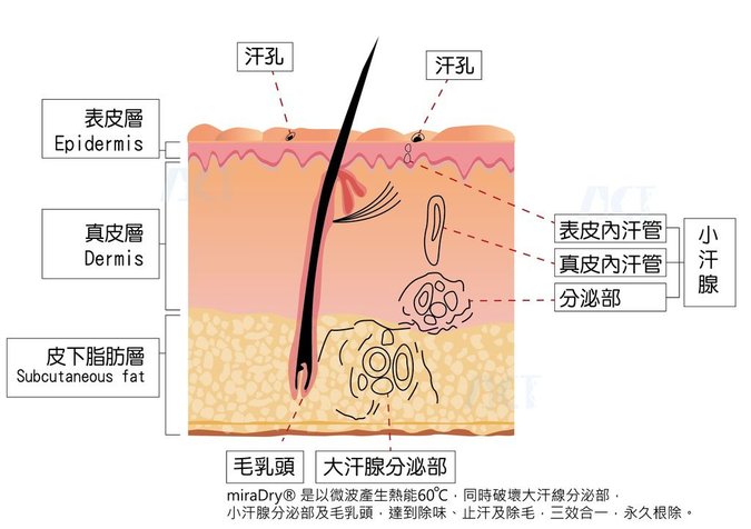 2016ACT皮膚圖-大小汗腺-轉外框.jpg