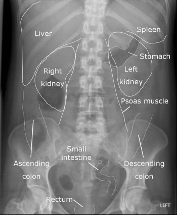 Rugal stomach folds nice AXR_small3.jpg