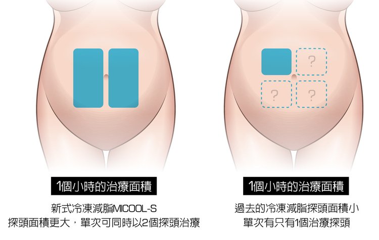 MICOOL-S冷凍溶脂副作用冷凍溶脂價錢冷凍減脂心得冷凍溶脂推薦冷凍溶脂ptt冷凍溶脂原理冷凍溶脂術後瘦肚子的方法快速瘦肚子運動瘦肚子按摩快速瘦小腹運動瘦肚子飲食瘦肚子有氧運動05.jpg