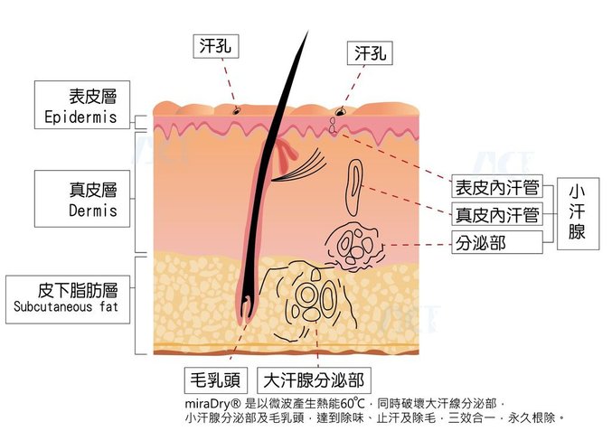 2016ACT皮膚圖-大小汗腺-轉外框.jpg