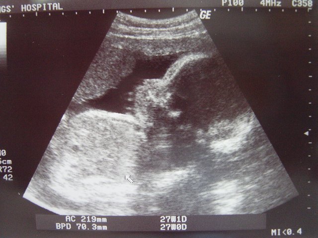 26W