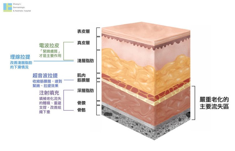 02-妳老了嗎？女性老化四大徵兆