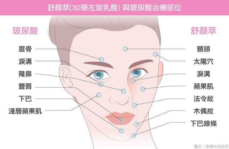 舒顏萃下巴童顏針額頭舒顏萃心得舒顏萃效果童顏針推薦高雄注射拉提高雄彤曜醫美沈育如醫師皮膚專科醫師舒顏萃玻尿酸04.jpg