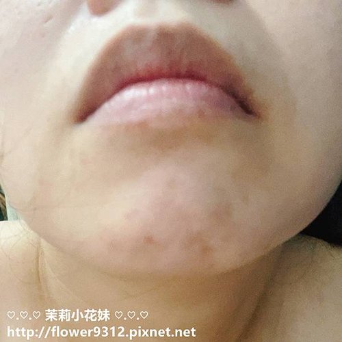 medicube RED積雪草集中修護霜 RED修護精華 (7).jpg