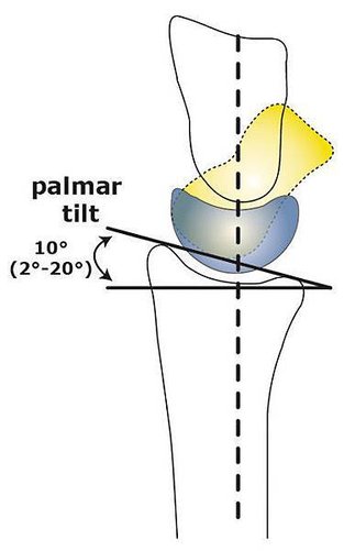 english-class-x-wrist-fig16-palmar-tilt.jpg