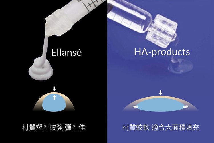 洢蓮絲玻尿酸3D聚左旋乳酸EllanséHA-products抗老拉提林上立醫師林上立醫生09.jpg