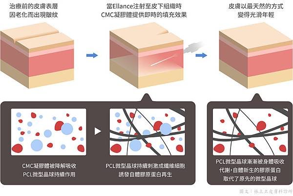 05-Skin texture-section.jpg