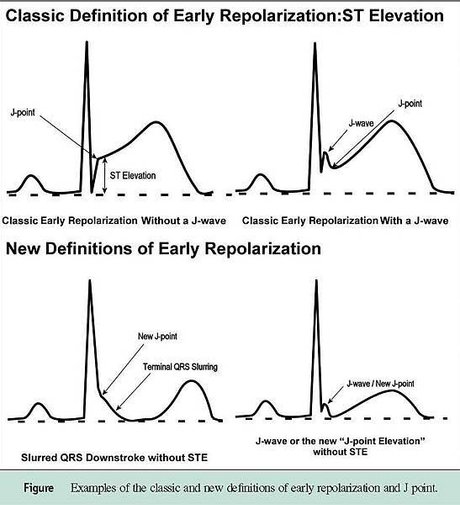 projects_repolarization_23_401991672.jpg