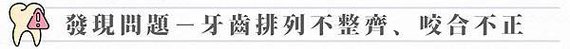 發現問題－牙齒排列不整齊、咬合不正