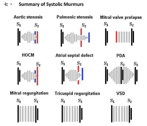 Systolic murmur統整