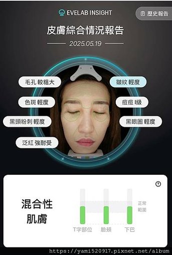 台北音波拉提診所分享 愛爾麗診所 𝐇𝐢𝐏𝐑𝐎-𝐒 龍捲風音波