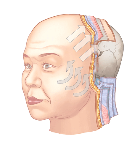 林上立 推薦 液態拉皮 推薦 舒顏萃 推薦 3D聚左旋乳酸 推薦 上立提 推薦 SCULPTRA 推薦 林上立 液態拉皮 推薦 童顏針 林上立 推薦 童顏針 推薦11