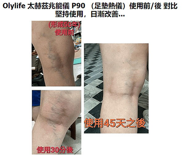 Olylife 太赫兹兆能儀：開啟健康科技的新時代