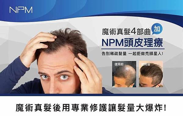 PMU偽裝NPM魔術真髮-NPM頭皮理療-01.jpg