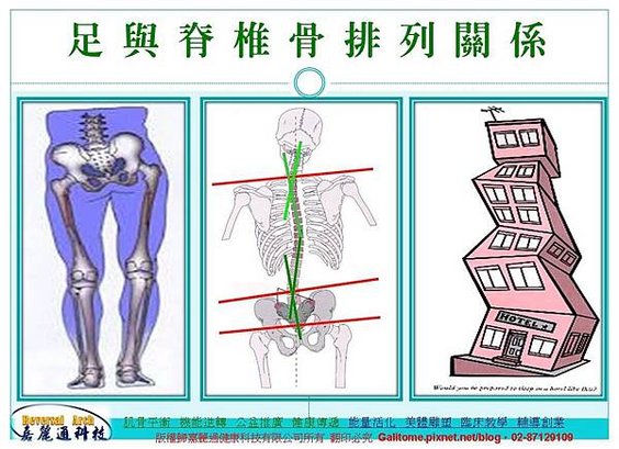 足弓腳正定位分析技術培訓班 5