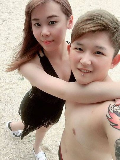 重獲自由（平胸手術）｛波菲特醫美診所｝更新2019/07/2