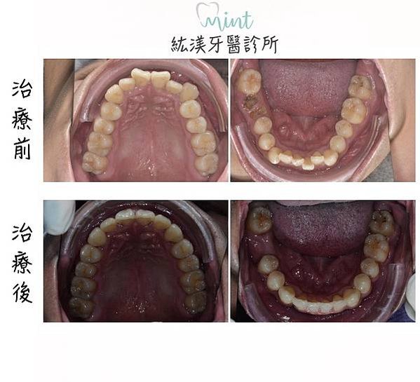 上下顎照