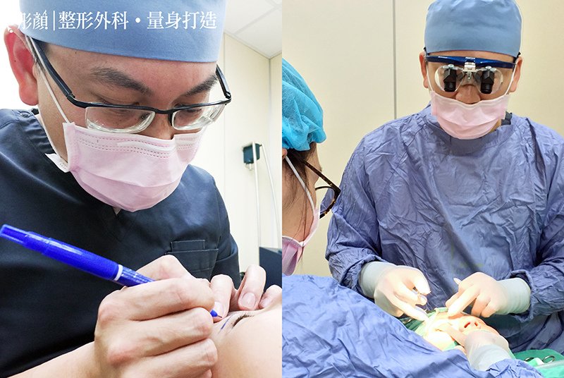 眼睛也有黃金比例！【訂書針雙眼皮+開眼頭】眼睛放大電力狂飆，人氣好感度UP！-整形外科 劉宏貞醫師-大小眼-蒙古摺