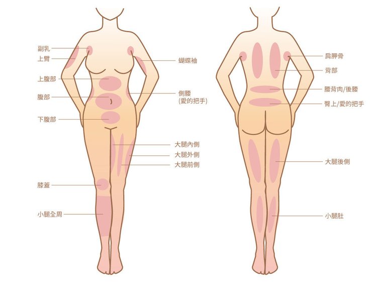 抽脂手術風險抽脂價格抽脂後遺症抽脂日記抽脂會痛嗎抽脂減肥抽脂原理02.jpg
