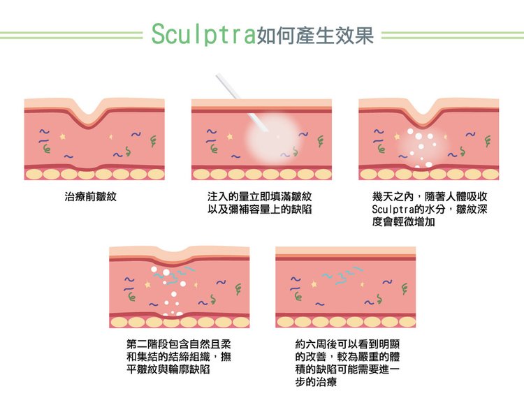 高雄舒顏萃按摩高雄舒顏萃價格舒顏萃失敗舒顏萃副作用舒顏萃ptt舒顏萃高雄法令紋舒顏萃洢蓮絲舒顏萃法令紋舒顏萃一瓶幾cc舒顏萃效果高雄聚左旋乳酸價格聚左旋乳酸按摩聚左旋乳酸副作用3d高雄聚左旋乳酸失敗聚左旋乳酸ptt3d聚左旋乳酸ptt3d聚左旋乳酸推薦3d聚左旋乳酸術後聚左旋乳酸淚溝高雄彤曜時尚診所沈育如