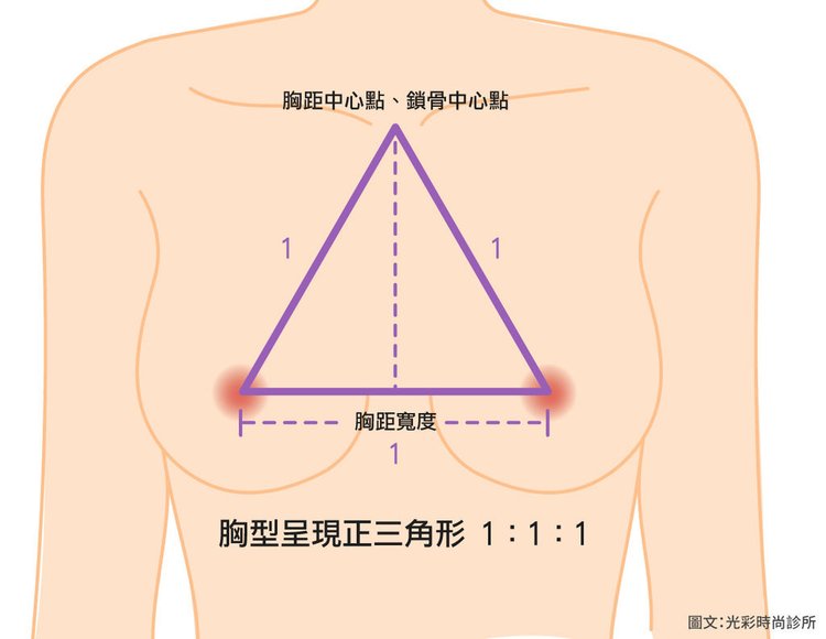 隆乳適應對象2019性感胸型乳溝內視鏡隆乳光彩時尚診所台北醫美推薦費用評價ptt術後修復期水滴隆乳果凍矽膠手術風險 (2).jpg