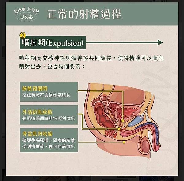 依年齡算做愛次數+縱慾過度 攝護腺易發炎+性行為或自慰次數，