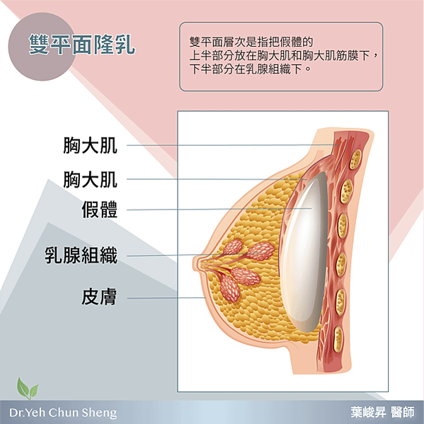 工作區域 2雙平面