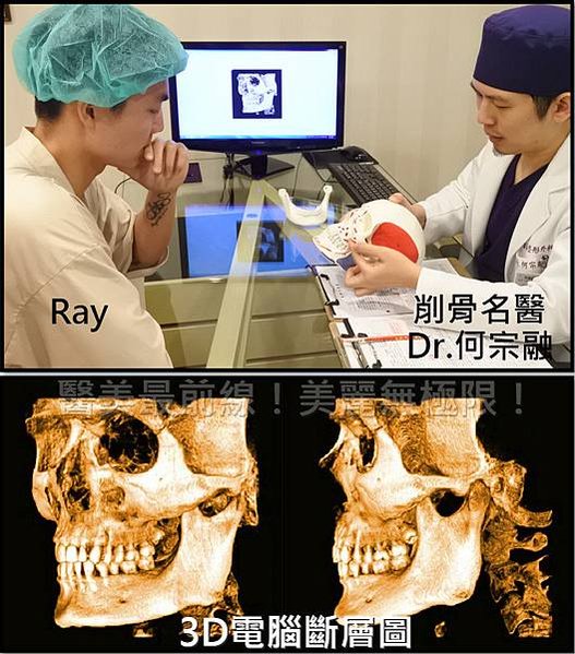 削骨手術3D電腦斷層