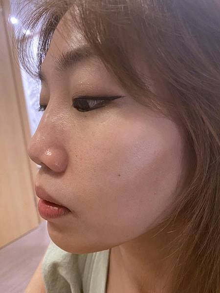 台中醫美診所-潘朵拉微整形